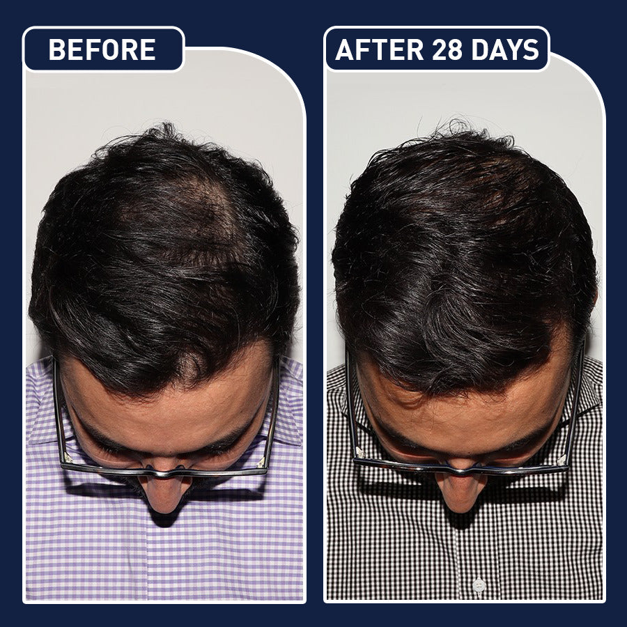 بخاخ FEG Plus لنمو الشعر – شعر أكثف، أطول، وأكثر صحة!