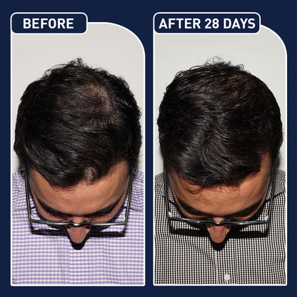 بخاخ FEG Plus لنمو الشعر – شعر أكثف، أطول، وأكثر صحة!