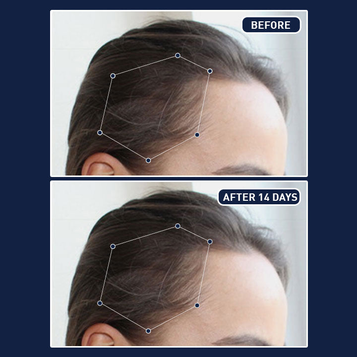 بخاخ FEG Plus لنمو الشعر – شعر أكثف، أطول، وأكثر صحة!