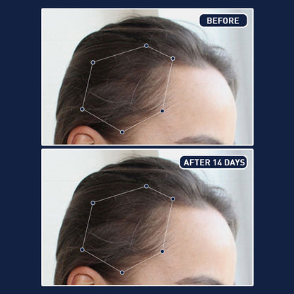 بخاخ FEG Plus لنمو الشعر – شعر أكثف، أطول، وأكثر صحة!